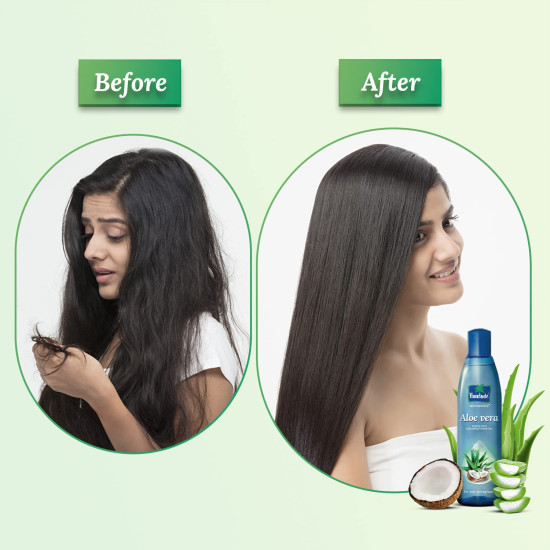 Parachute Advansed Aloe Vera Enriched Coconut Hair Oil - Nourishing & Softening Formula