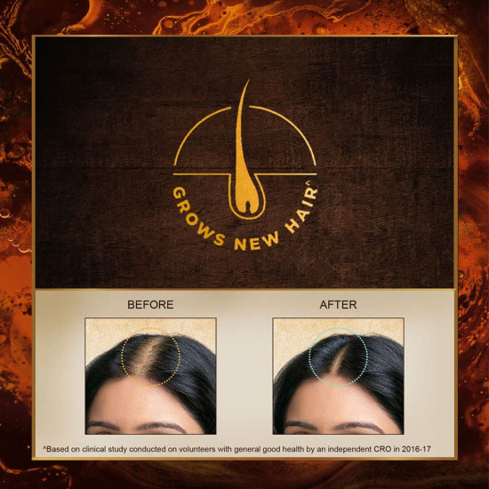 Indulekha Bringha Ayurvedic Hair Oil - Hair Fall Control with Amla & Coconut Oil