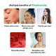 Kerala Ayurveda Khadirarishta 450ml - Herbal Blood Purifier for Acne Relief