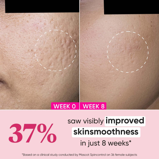 Dot & Key Night Reset Retinol + Ceramide Night Cream - Anti Aging & Moisturizing Dot & Key Night Reset Retinol + Ceramide Night Cream - Anti Aging & Moisturizing