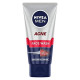 NIVEA MEN Acne Control Face Wash - 12 Hr Oil Control