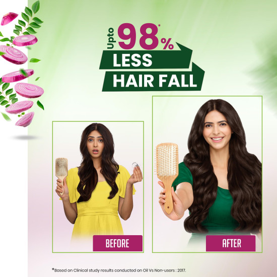 Kesh King Organic Onion Oil - Reduces Hair Fall & Boosts Growth