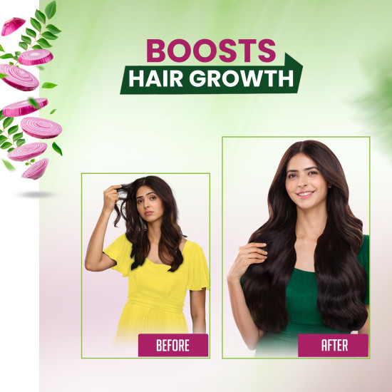 Kesh King Organic Onion Oil - Reduces Hair Fall & Boosts Growth