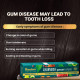 Himalaya Ayurveda Gum Care Toothpaste - Herbal Gum Protection