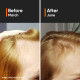 Minimalist Hair Growth Serum - 18% Hair Growth Actives for Hair Fall Control Minimalist Hair Growth Serum - 18% Hair Growth Actives for Hair Fall Control