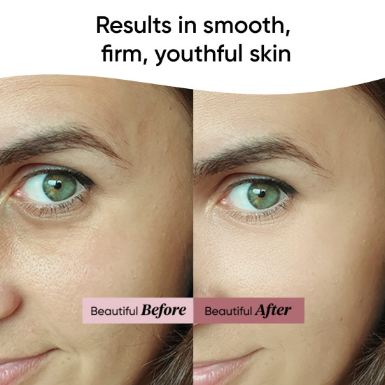 Dot & Key Night Reset Retinol + Ceramide Night Cream - Anti Aging Moisturizer