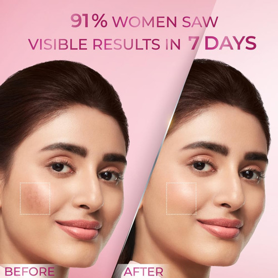 Pond's Bright Beauty Anti-Pigmentation Serum - Flawless Radiance