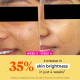 Dot & Key Vitamin C + E Sorbet Super Bright Moisturizer - For Glowing Skin Dot & Key Vitamin C + E Sorbet Super Bright Moisturizer - For Glowing Skin
