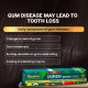 Himalaya Ayurveda Gum Care Toothpaste - Ayurvedic Herbal Formula