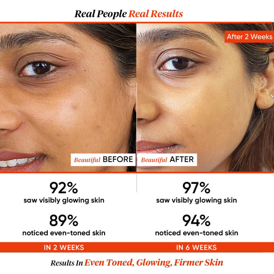 Dot & Key 20% Vitamin C Face Serum - Skin Glow & Pigmentation Reduction