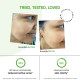 Dot & Key 2% Salicylic Acid + Cica Anti Acne Serum - Clear & Radiant Skin