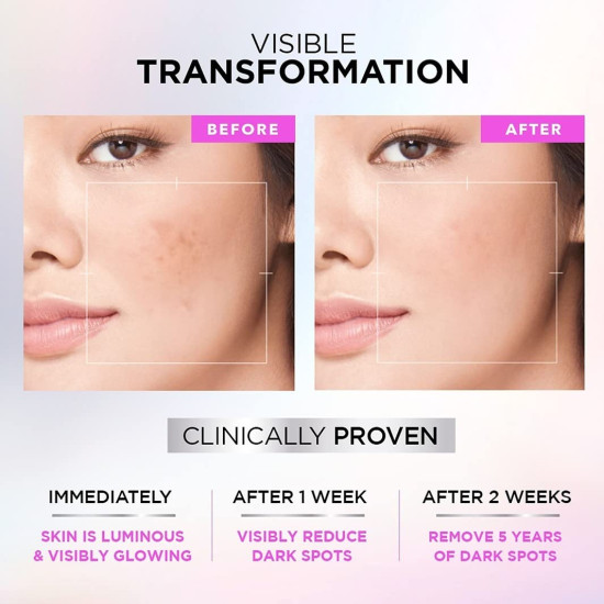 L'Oreal Paris Glycolic Bright Skin Brightening Serum & Day Cream - 1% Glycolic Acid for Dark Spots