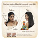 Parachute Advansed Ayurvedic Coconut Hair Oil - Reduces Dandruff & Hairfall