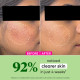 Dot & Key CICA + Niacinamide Oil-Free Moisturizer - Fades Dark Spots