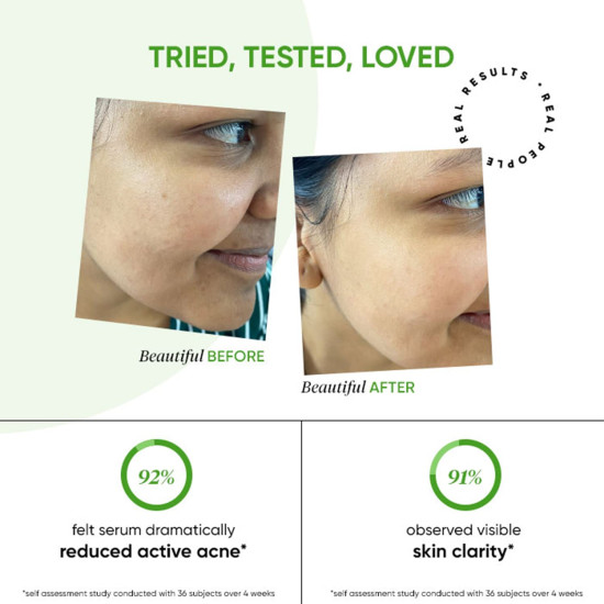 Dot & Key 2% Salicylic Acid + Cica Anti Acne Serum - Oil-Free & Non Comedogenic