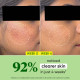 DOT & KEY Cica + Niacinamide Oil-Free Face Moisturizer - Acne Fighter DOT & KEY Cica + Niacinamide Oil-Free Face Moisturizer - Acne Fighter