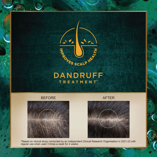Indulekha Svetakutaja Oil - Ayurvedic Dandruff Treatment Indulekha Svetakutaja Oil - Ayurvedic Dandruff Treatment