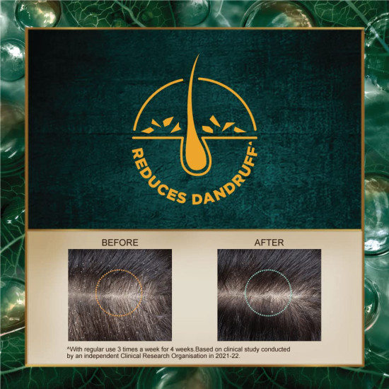 Indulekha Dandruff Treatment Shampoo 340 Ml - Ayurvedic Dandruff Solution