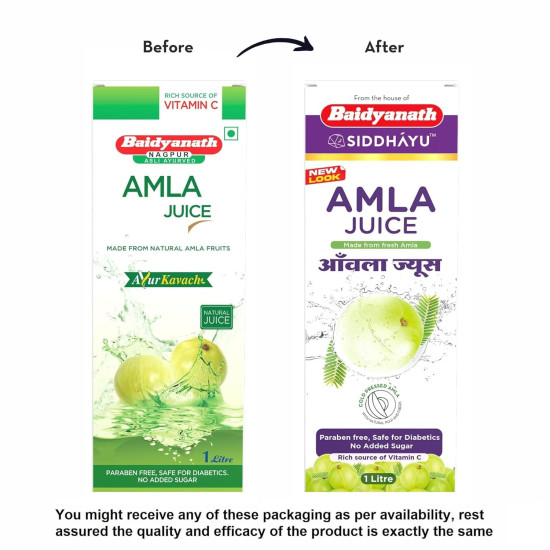 Baidyanath Asli Ayurved Amla Juice 1L Cold Press + Aloe Vera Juice 1L | Cold-Pressed, Vitamin C, Supports Immunity & Digestion, Combo For Glowing Skin, Hair Care, And Detox